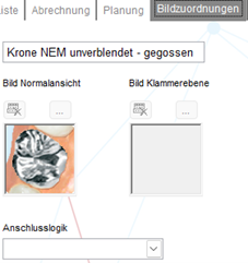bildzuorfung_kn.png